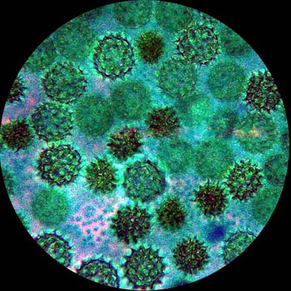 AmScope IN480 Series Inverted Infinity-corrected Phase-contrast Trinocular Compound Microscope 40X-1500X Magnification with Koehler Illumination and 18MP USB 3.0 Camera
